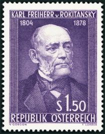 150th Birth Anniversary of Karl Freiherr von Rokitansky