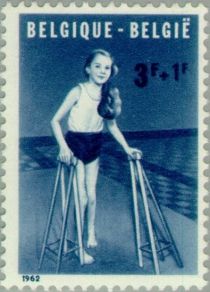 Infantile Paralysis (Polio)